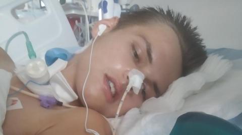 17-letni Piotrek ucierpiał w wypadku. "Lekarze kazali nam przygotować się na najgorsze"